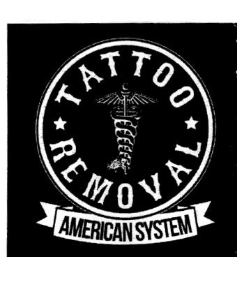 TATTOO REMOVAL AMERICAN SYSTEM