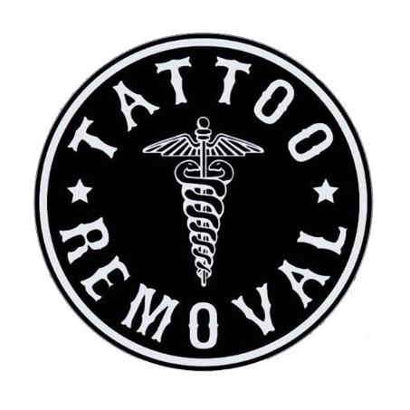 TATTOO REMOVAL